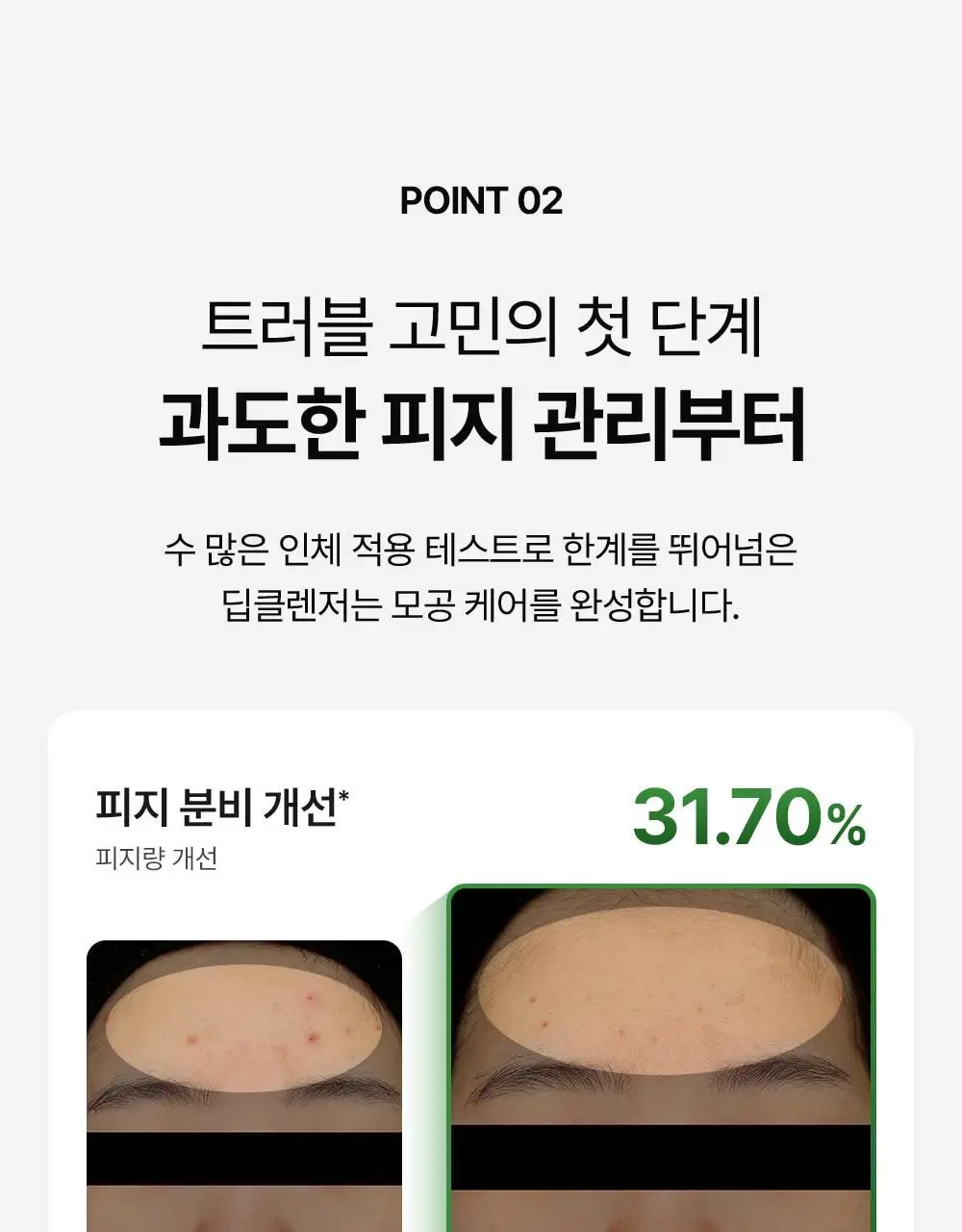 [트러블 진정] 메디필 그린 시카 콜라겐 클리어 젤 클렌저 2.0 300ml 상세페이지 12